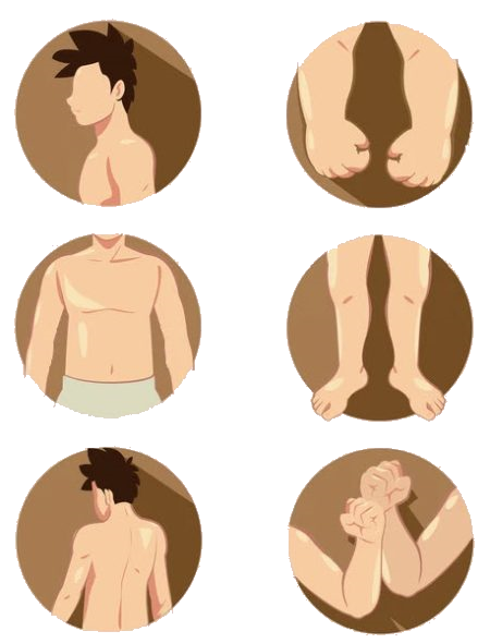 berbagai-penyakit-kutil-badan